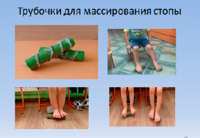 missing image file